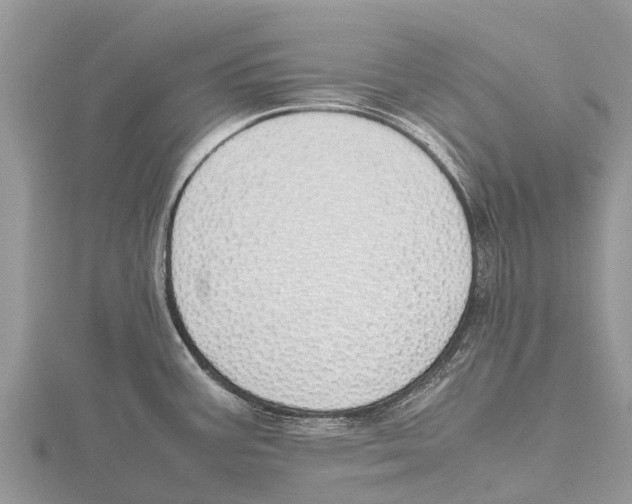 X0000115621387200912081014