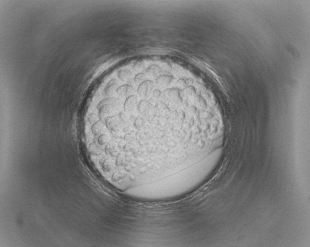 X0000115621404200912081013