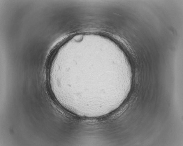 X0000115621406200912081013