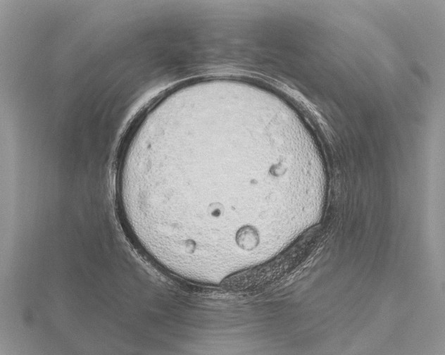 X0000115621416200912081013