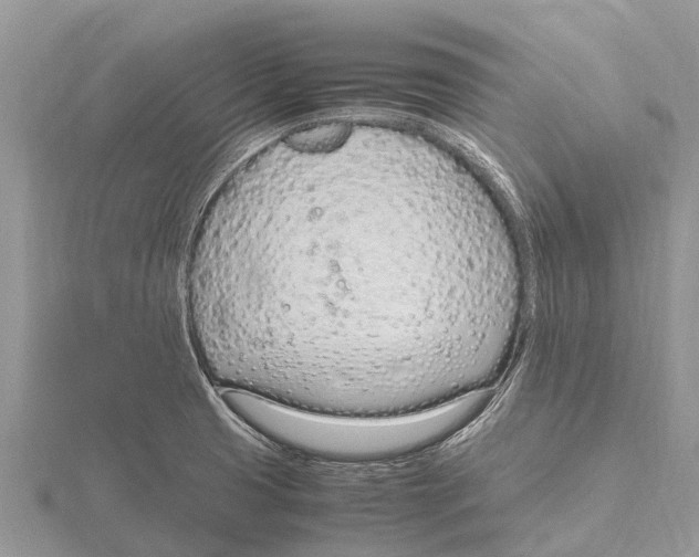 X0000115621425200912081014