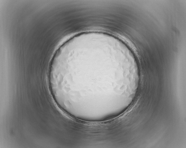 X0000115621429200912081014