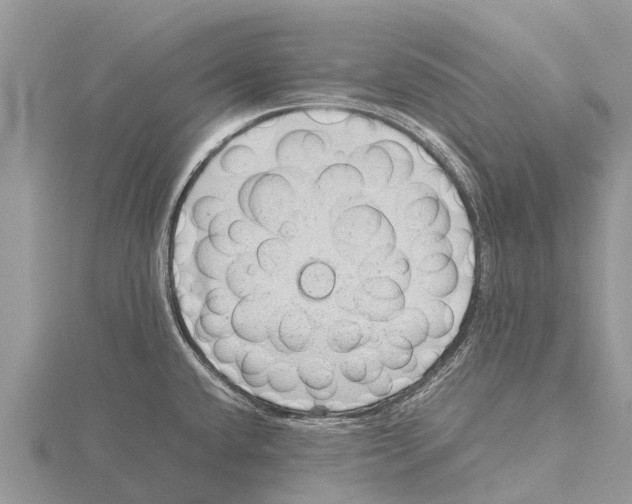 X0000115621432200912081014