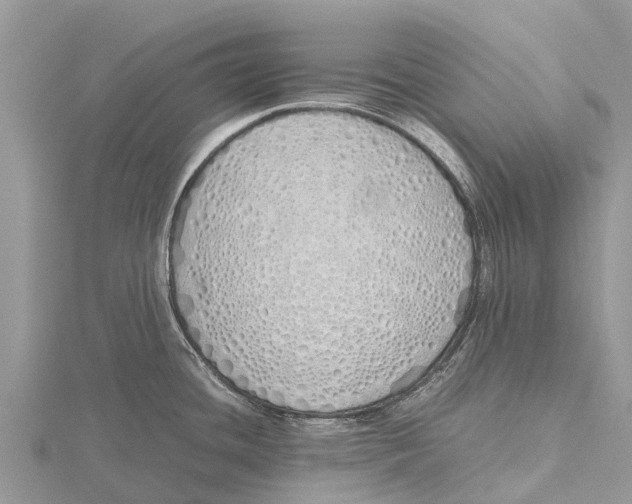 X0000115621436200912081014