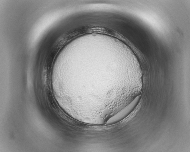 X0000115621438200912081014