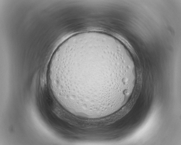 X0000115621439200912081014