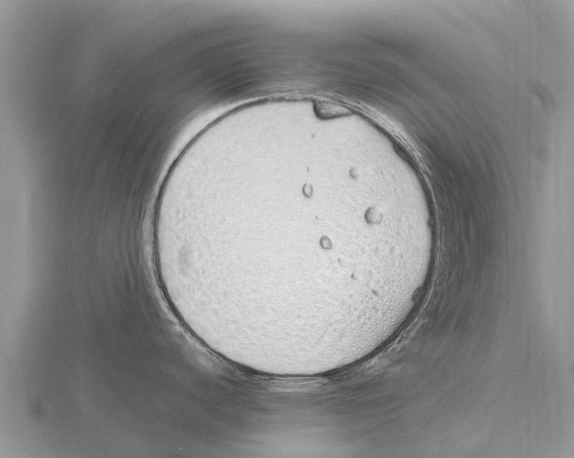 X0000115621440200912081014