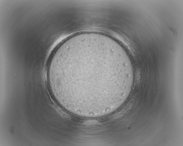 X0000115621462200912081013