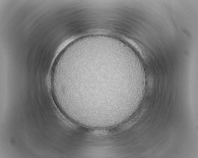 X0000115621466200912081013