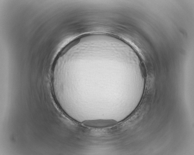 X0000115621477200912081013