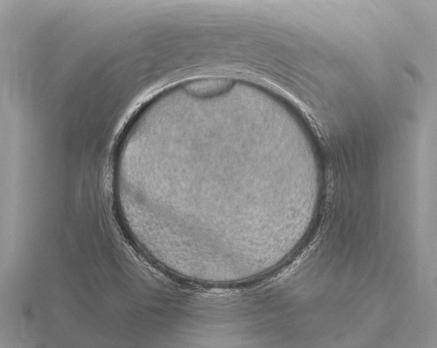 X0000115621506200912081012