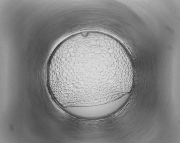 X0000115621519200912081012