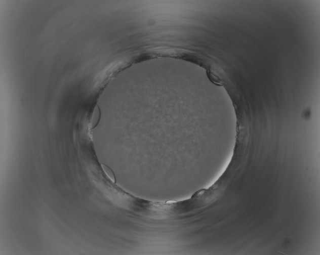 X0000115620143200912221236