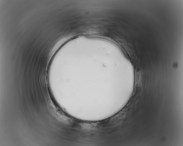 X0000115620147200912221235