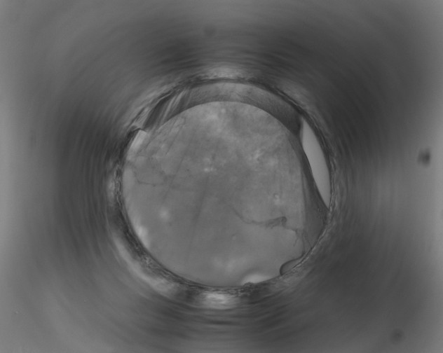 X0000115620167200912221235