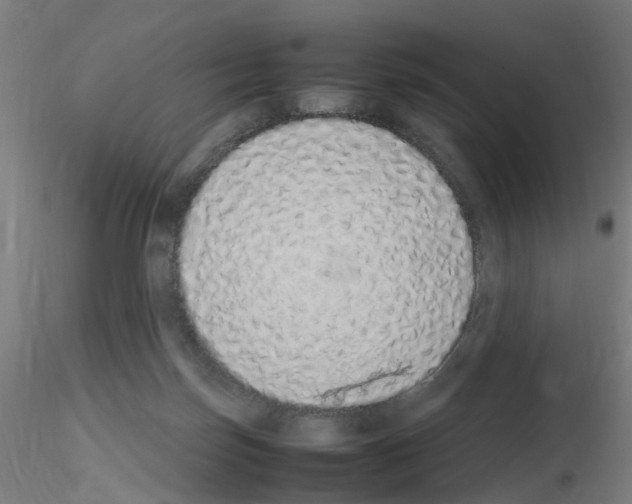 X0000115620171200912221235