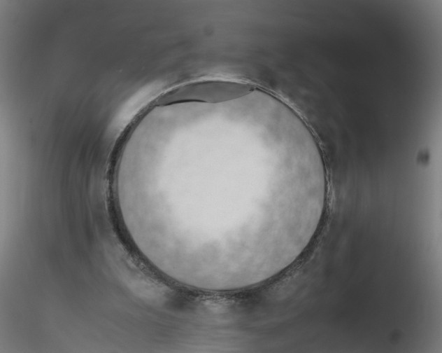 X0000115620199200912221235