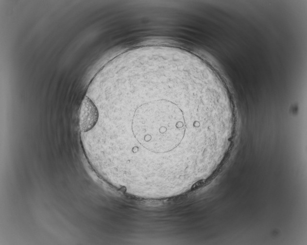 X0000115621049200912221224