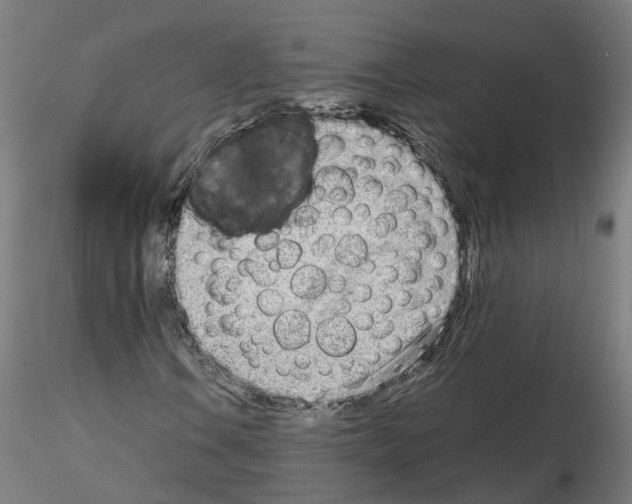X0000115621106200912221222