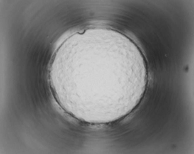 X0000115621386200912221219