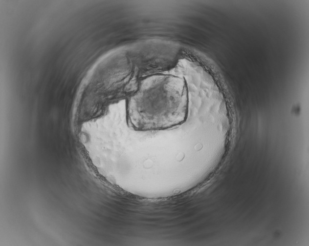 X0000115621409200912221218