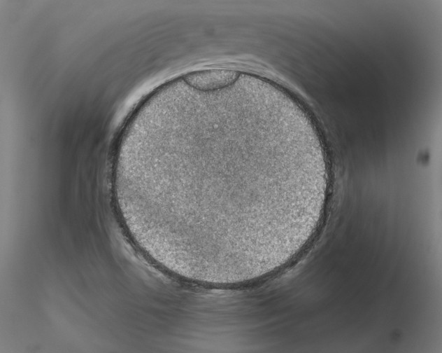 X0000115621506200912221217