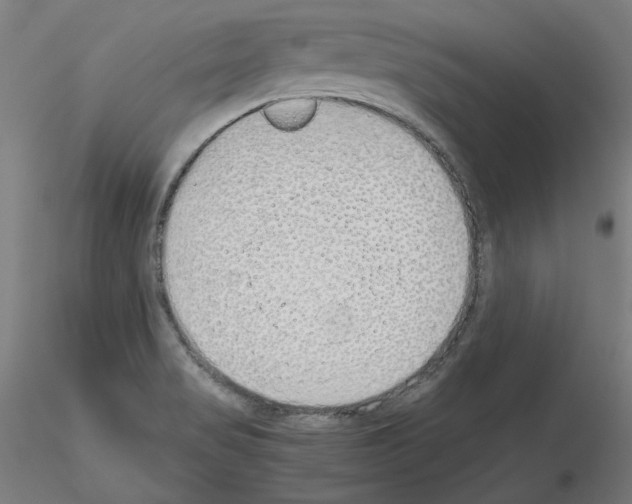 X0000115621517200912221217