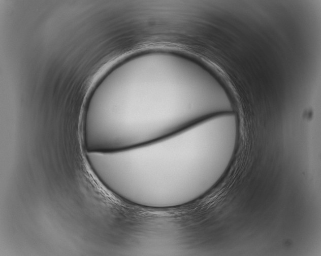 X0000115631199200911101112