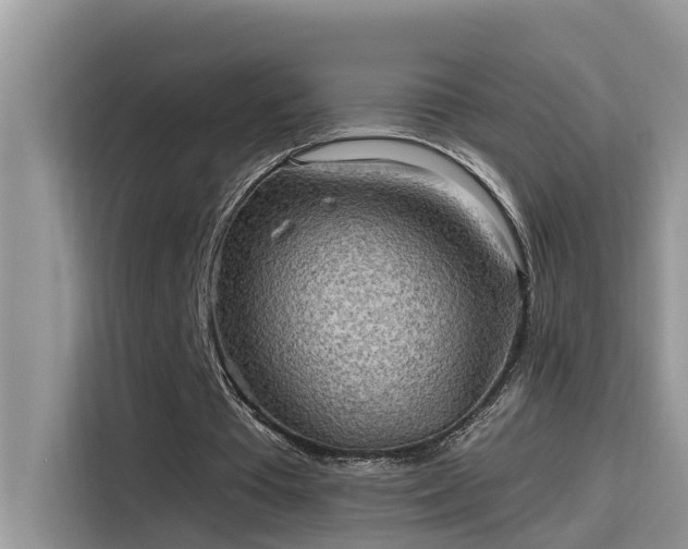 X0000115630385200911171340