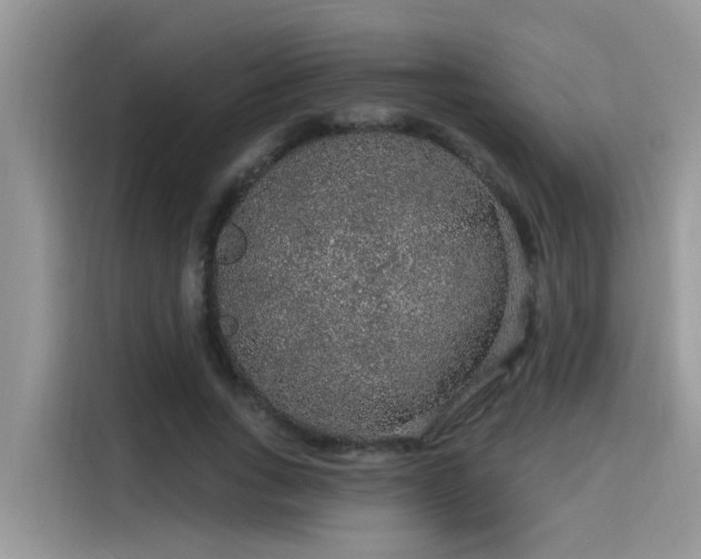 X0000115630735200911171335