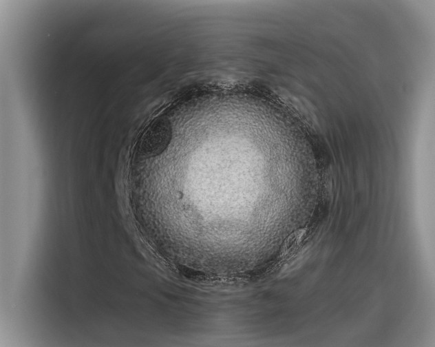 X0000115631105200911171330