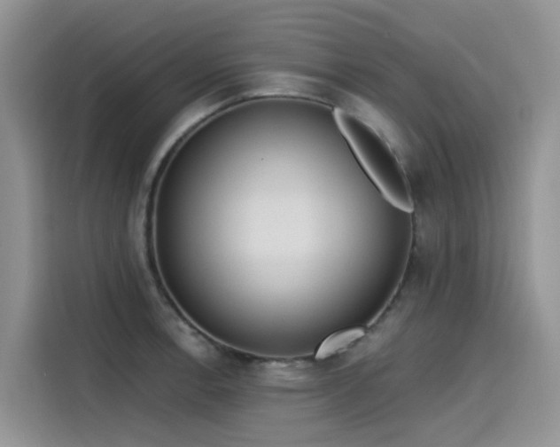 X0000115631138200911171330