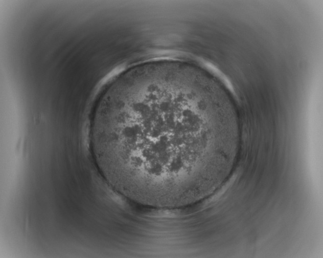X0000115631411200911171327