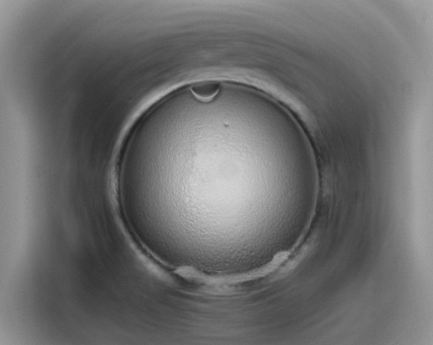 X0000115631517200911171325