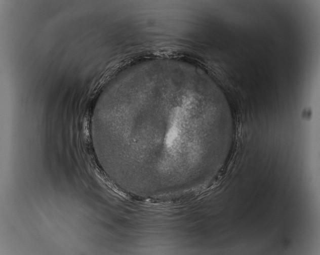 X0000115631106200911241640