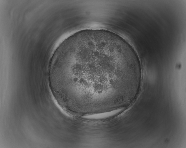 X0000115631429200911241637