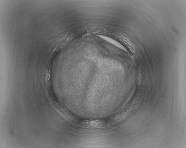 X0000115630365200912011445