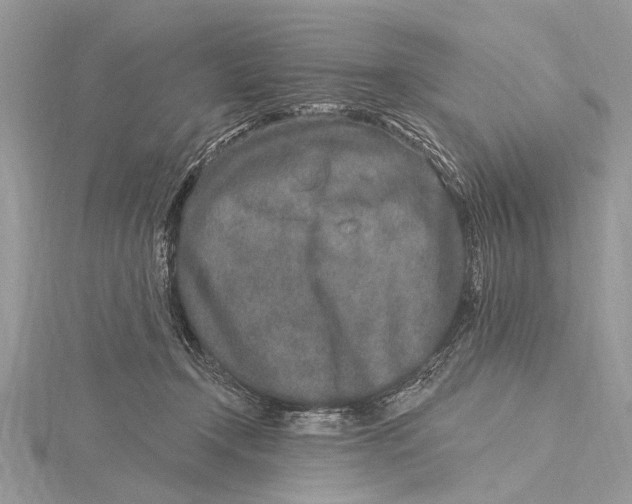 X0000115630366200912011445