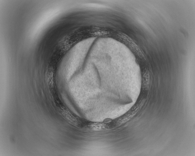 X0000115630762200912011440