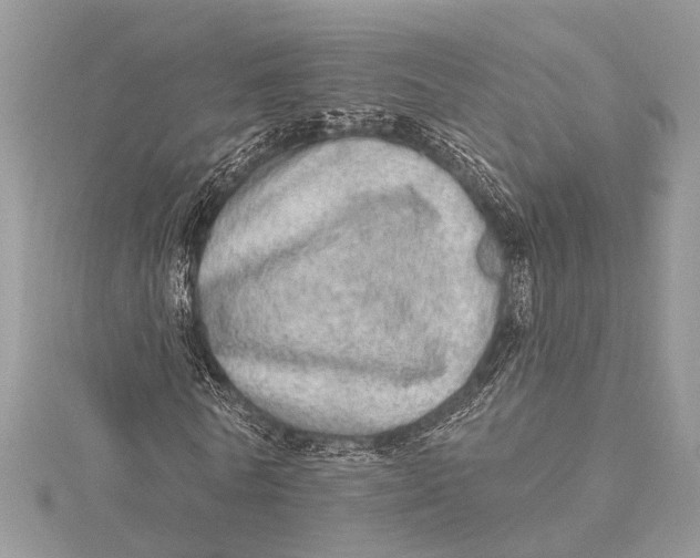 X0000115630770200912011440