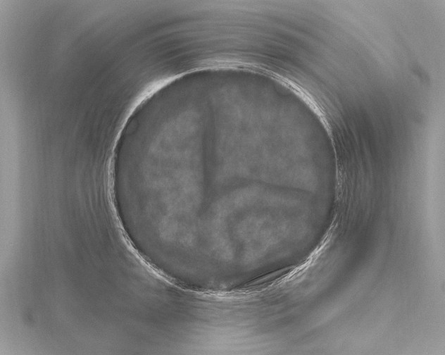 X0000115631045200912011436