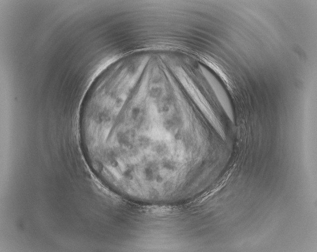 X0000115631087200912011435