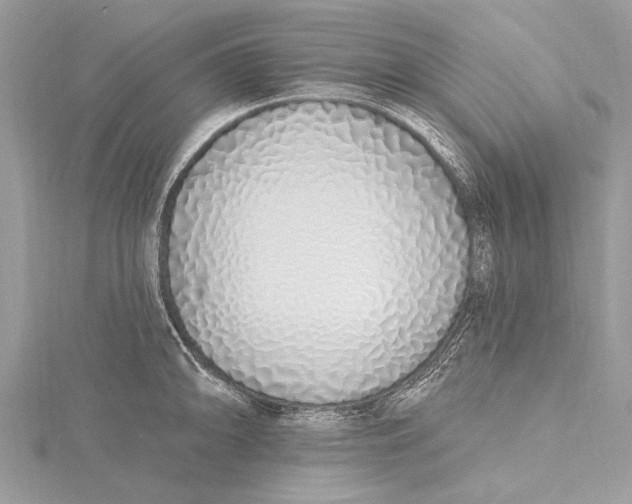 X0000115631094200912011435