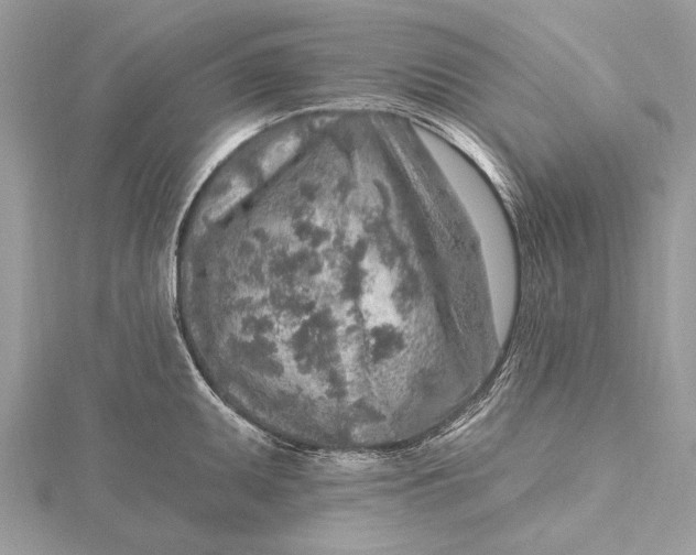 X0000115631095200912011435