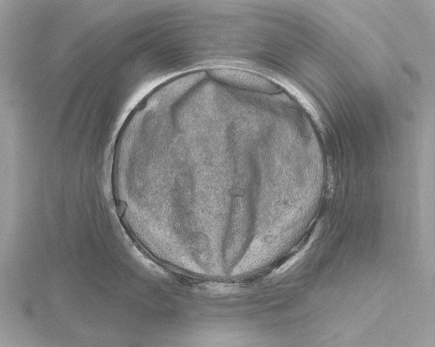 X0000115631102200912011435