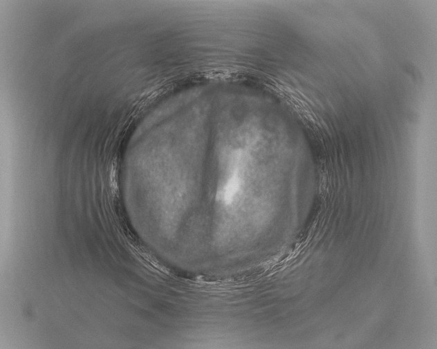 X0000115631106200912011434