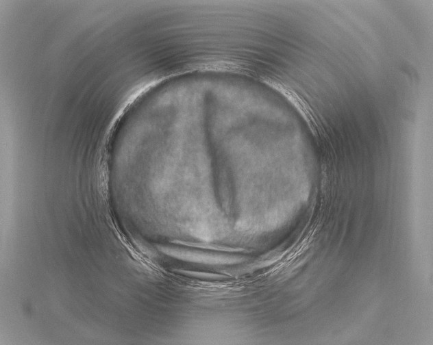 X0000115631115200912011435