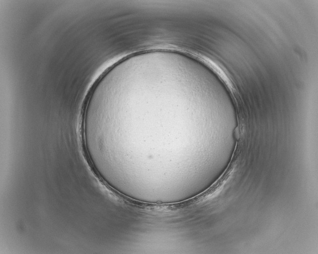 X0000115631149200912011435