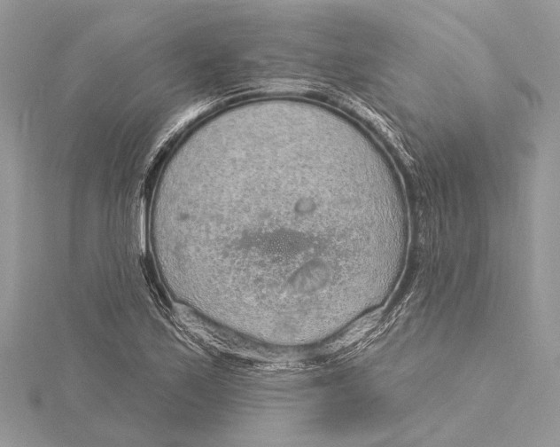 X0000115631171200912011434