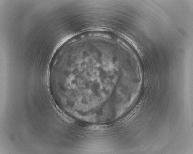 X0000115631179200912011434